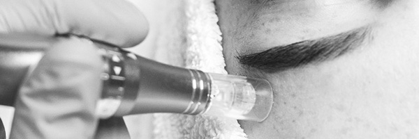 view dermapen microneedling